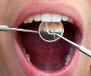 Dental Exam Close-Up