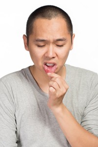 Man with Canker Sore on Lip