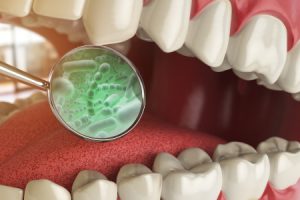 Bacteria & Microbes Around Tooth